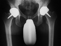 kinder fusschirurgie